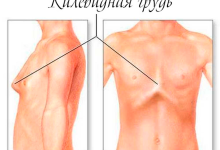 Photo of Оперативное вмешательство при деформациях