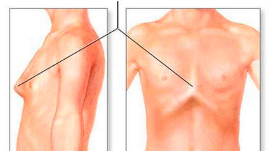 Photo of Оперативное вмешательство при деформациях