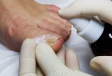 Photo of Подология: уход за ногами