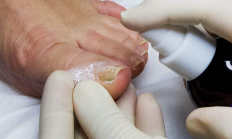 Photo of Подология: уход за ногами