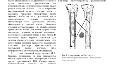 Photo of Восстановительная хирургия суставов