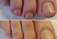 Photo of Подология: ключ к комфорту