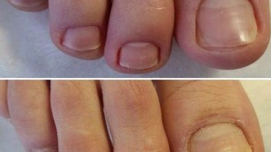 Photo of Подология: ключ к комфорту
