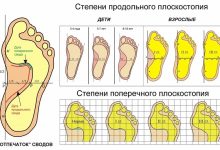 Photo of Развитие стопы у малышей