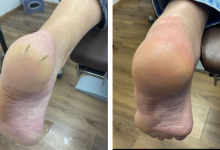 Photo of Подология: здоровье стоп