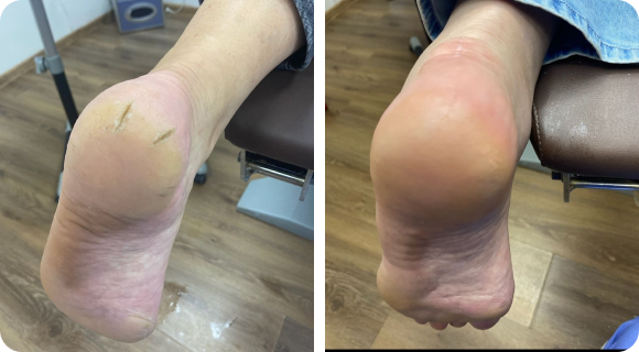 Photo of Подология: здоровье стоп