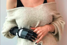 Photo of Протезирование для спортсменов после повреждений