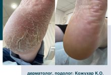 Photo of Почему важно заботиться о ногах