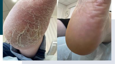 Photo of Почему важно заботиться о ногах