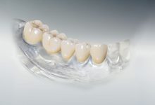 Photo of Современные технологии в ортопедии