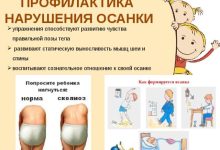 Photo of Как улучшить осанку ребенка?