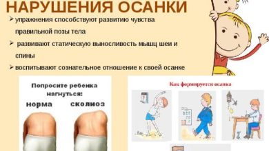Photo of Как улучшить осанку ребенка?
