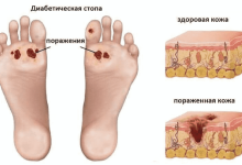 Photo of Зачем нужна подология
