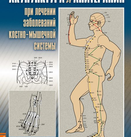 Photo of Акупунктура: древний метод лечения