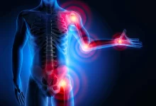 Photo of Избавляемся от боли в суставах