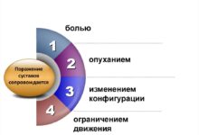 Photo of Симптомы болезней суставов