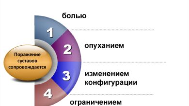 Photo of Симптомы болезней суставов