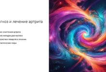 Photo of Лечение артрита: современные методы