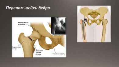Photo of Как избежать травм суставов