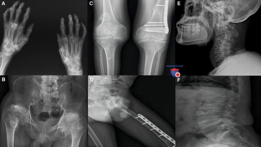 Фото 77 — Здоровье коленных суставов: советы врачей