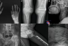 Photo of Здоровье коленных суставов: советы врачей