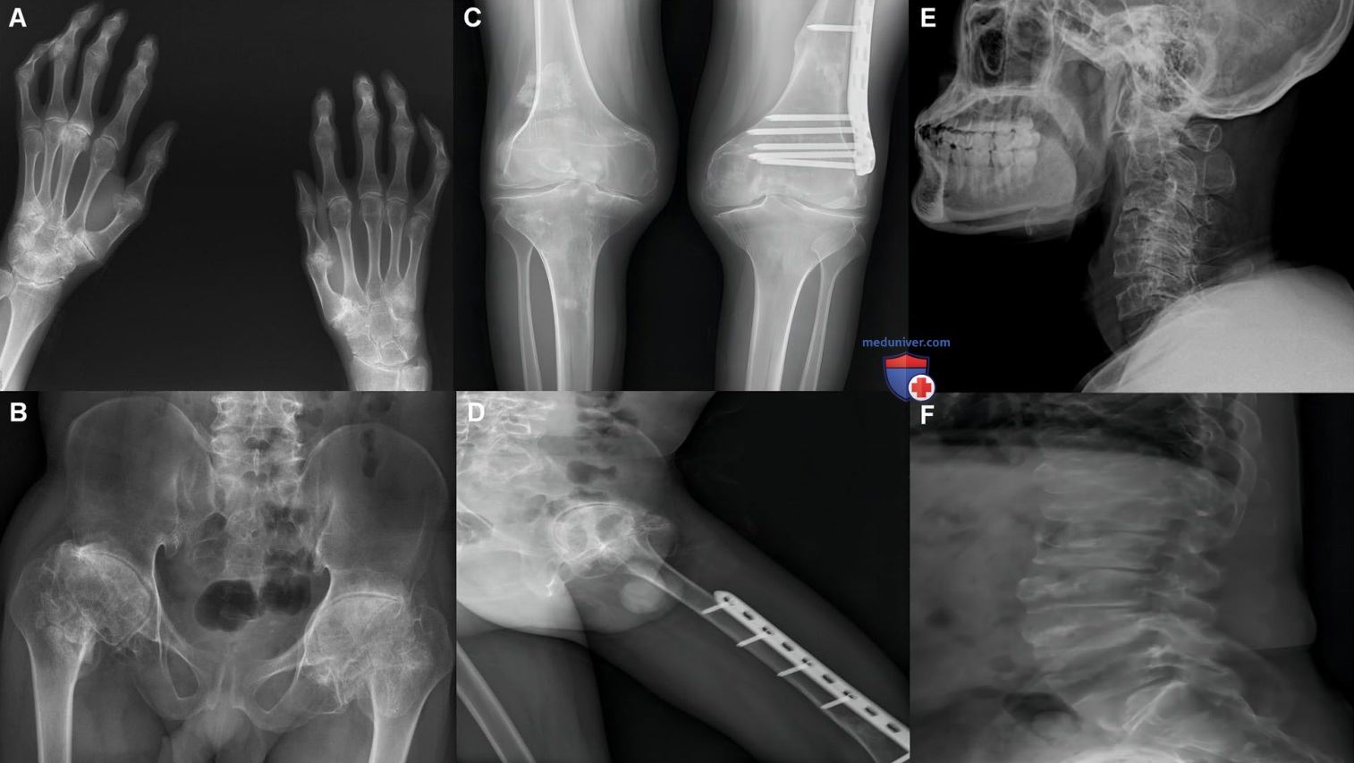 Фото 77 — Здоровье коленных суставов: советы врачей